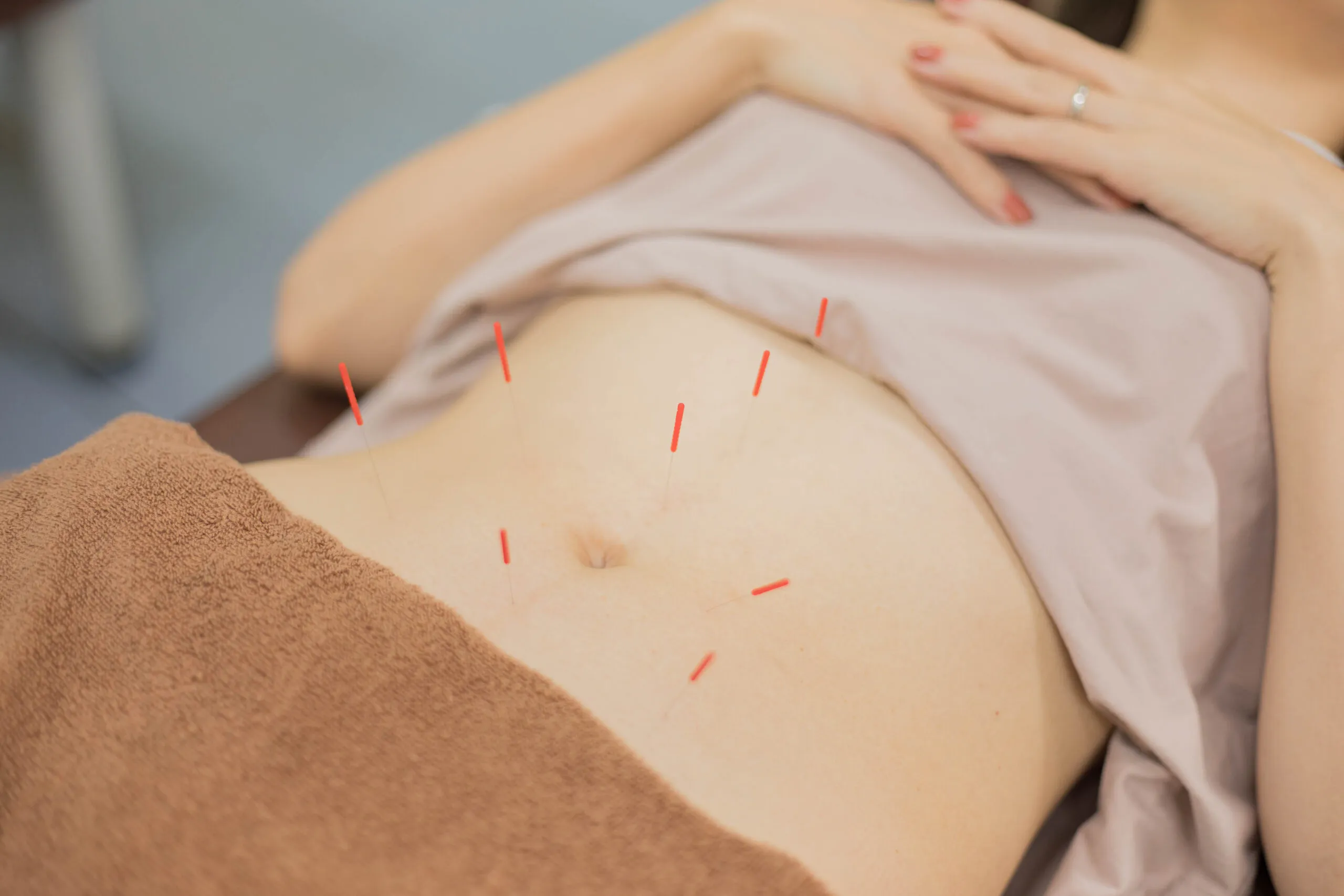 日本橋八重洲接骨院の経穴へのアプローチ施術の様子