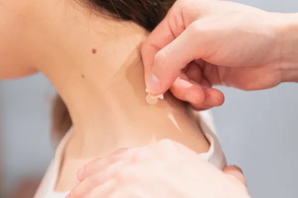 経穴(ツボ)へのアプローチアイコン