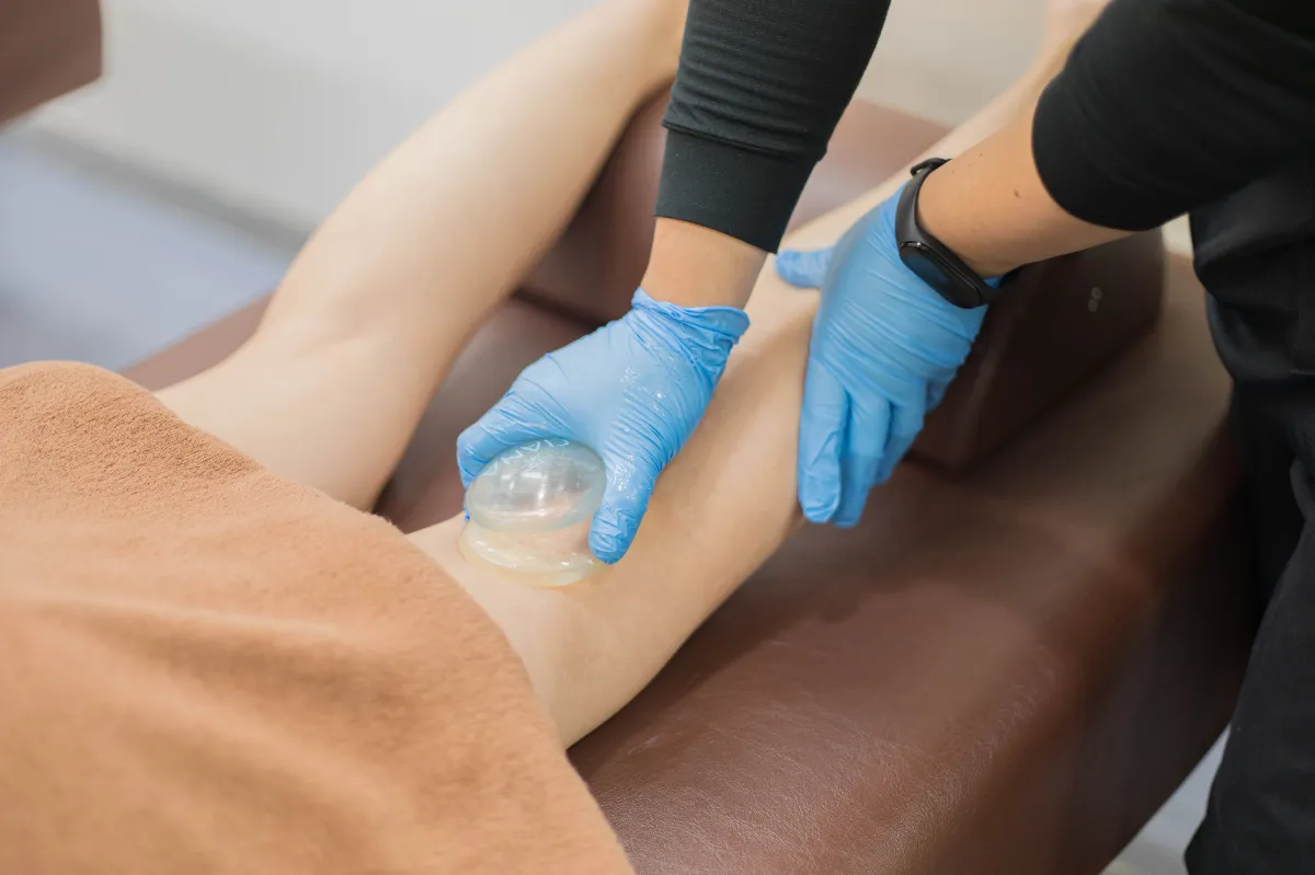 セルライトを効率的に排出するセルライトカッピングドレナージュ