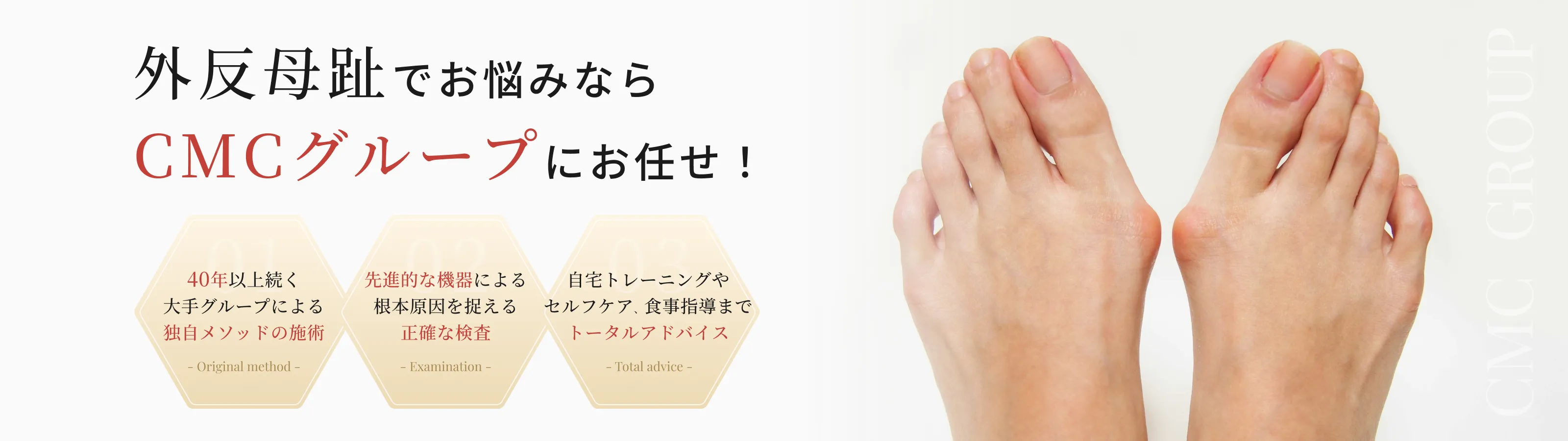 外反母趾 イメージ